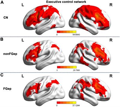 Altered Structural and Functional Patterns Within Executive Control Network Distinguish Frontal Glioma-Related Epilepsy